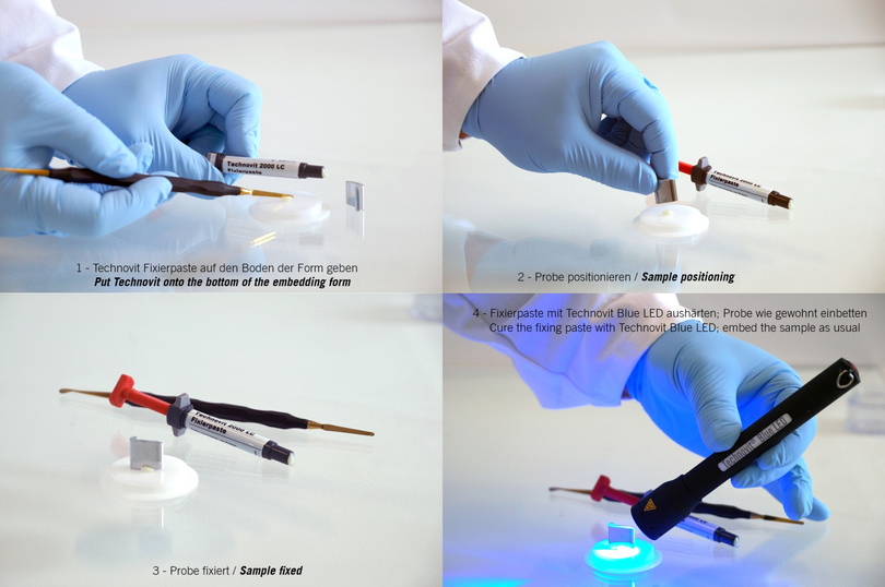 Práce se světlem vytvrzovanou hmotou Technovit 2000 LC